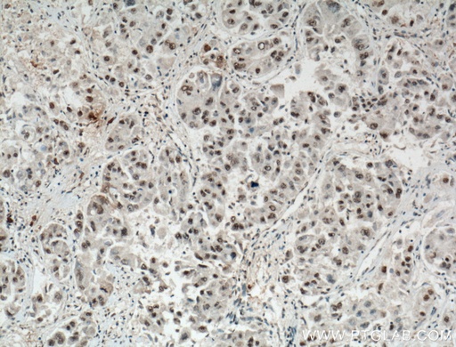 [66500-1-IG-20UL] TAZ Monoclonal antibody