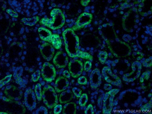 [66501-1-IG-150UL] PCCB Monoclonal antibody