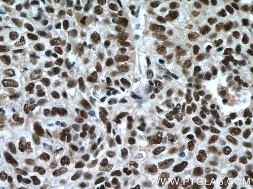 [66508-1-IG-20UL] SP1 Monoclonal antibody