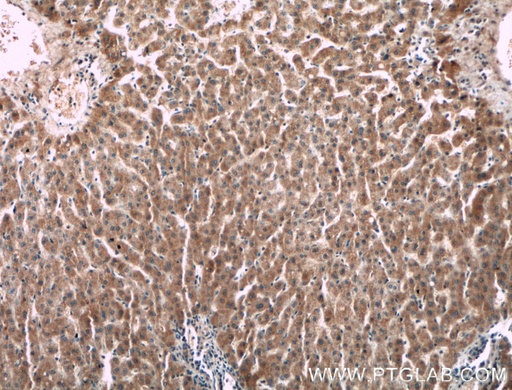 [66509-1-IG-150UL] F2 Monoclonal antibody