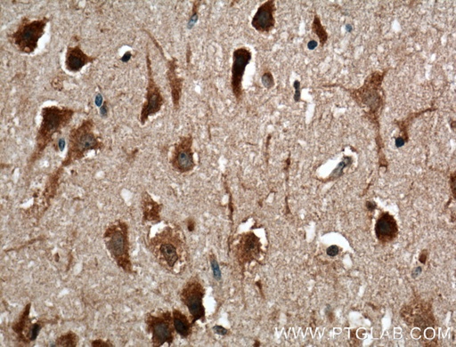 [66513-1-IG-20UL] OLIG2 Monoclonal antibody