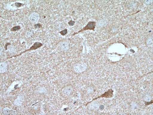 [66518-1-IG-150UL] MKS1 Monoclonal antibody