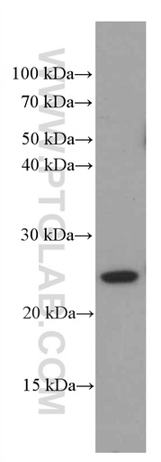 [66521-1-IG-20UL] Recoverin Monoclonal antibody