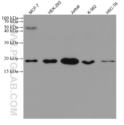[66524-1-IG-150UL] CGGBP1 Monoclonal antibody