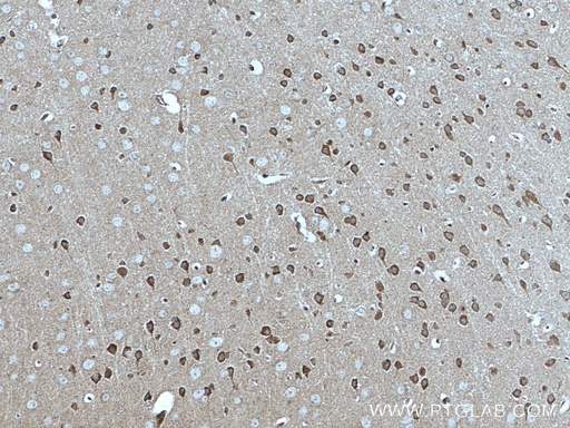 [66527-1-IG-150UL] MFF Monoclonal antibody