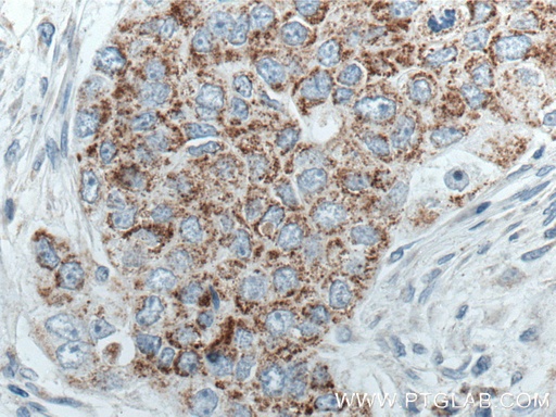 [66531-1-IG-20UL] MRPL45 Monoclonal antibody