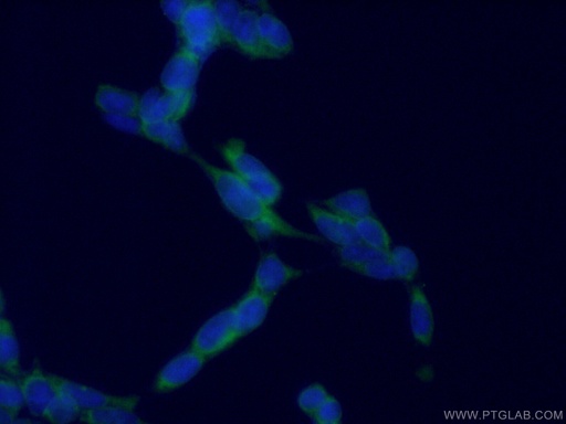 [66533-1-IG-150UL] AP5Z1/SPG48 Monoclonal antibody