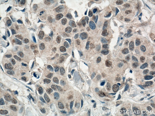 [66536-1-IG-20UL] AMPK Alpha Monoclonal antibody