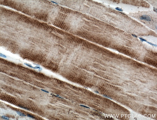 [66539-1-IG-150UL] RYR1 Monoclonal antibody