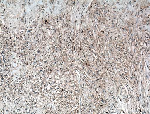 [66540-1-IG-20UL] Calponin Monoclonal antibody