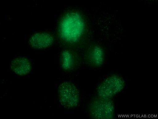 [66541-1-IG-20UL] TOP2A Monoclonal antibody