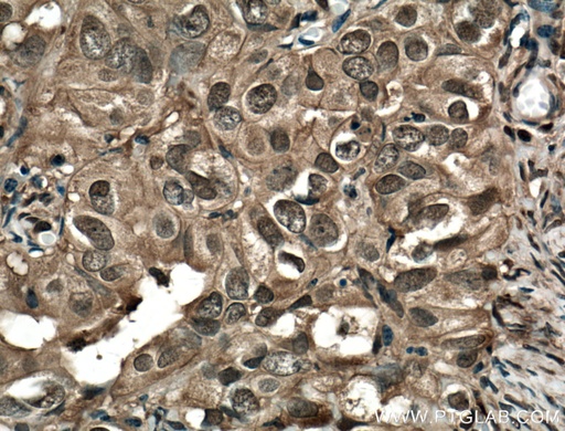 [66545-1-IG-20UL] STAT1 Monoclonal antibody
