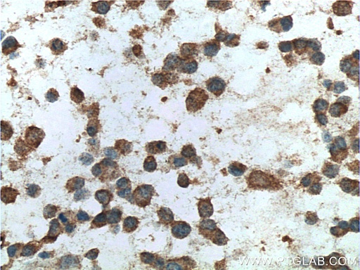 [66548-1-IG-20UL] FMR1 Monoclonal antibody