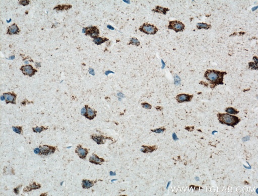 [66550-1-IG-20UL] ARC Monoclonal antibody