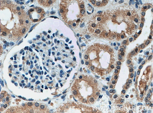[66551-1-IG-20UL] YME1L1 Monoclonal antibody