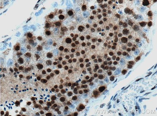 [66552-1-IG-150UL] NHEJ1 Monoclonal antibody