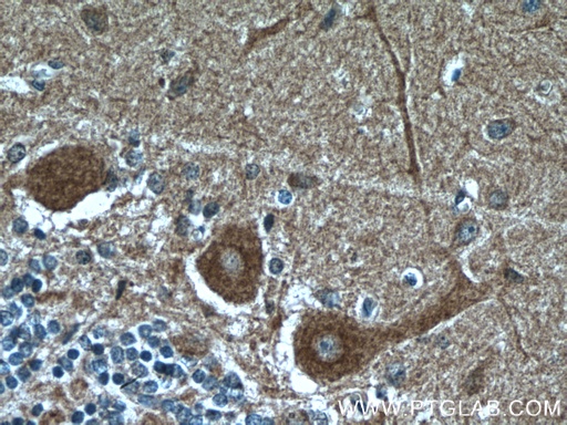 [66553-1-IG-20UL] Huntingtin Monoclonal antibody