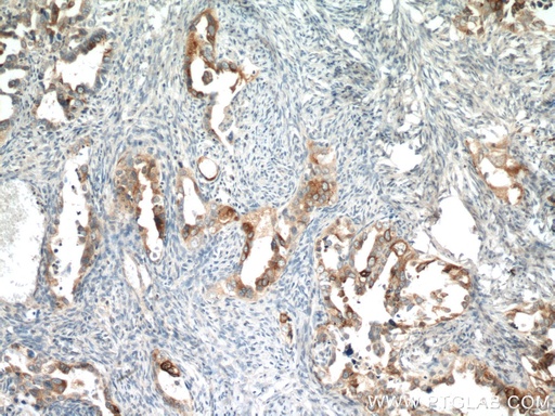 [66557-1-IG-20UL] HE4 Monoclonal antibody