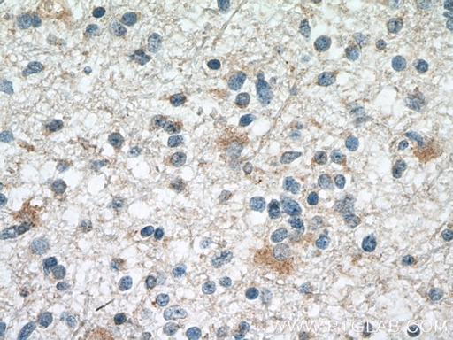 [66559-1-IG-20UL] SMAD1 Monoclonal antibody