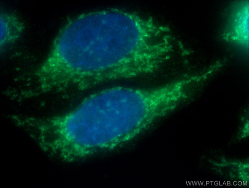 [66562-1-IG-150UL] TOMM22 Monoclonal antibody
