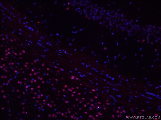[66564-1-IG-20UL] TBR1 Monoclonal antibody
