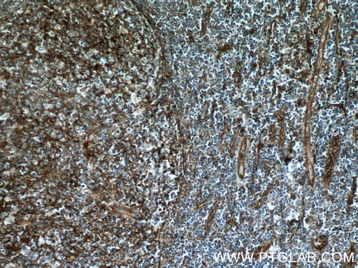 [66567-1-IG-20UL] CD151 Monoclonal antibody