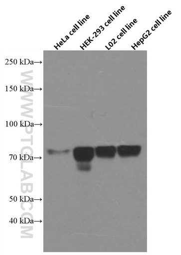 [66568-1-IG-20UL] FOXC1 Monoclonal antibody