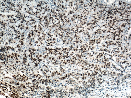 [66573-1-IG-20UL] NUP62 Monoclonal antibody