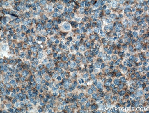 [66576-1-IG-20UL] c-Cbl Monoclonal antibody