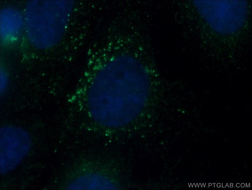 [66577-1-IG-20UL] SLC9A9 Monoclonal antibody