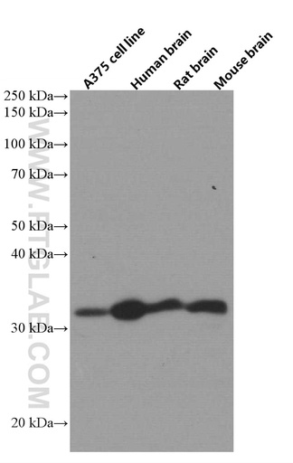[66579-1-IG-150UL] AMPK Beta 2 Monoclonal antibody