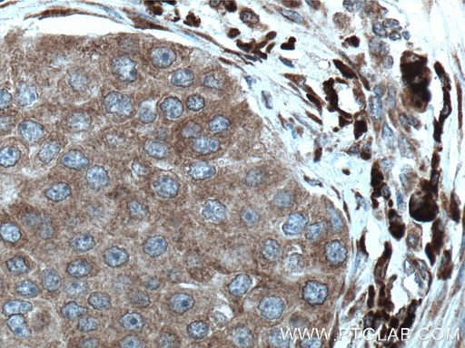 [66581-1-IG-20UL] STT3A Monoclonal antibody