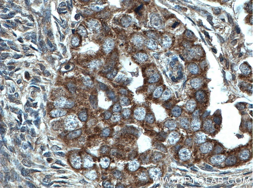 [66584-1-IG-150UL] CHCHD5 Monoclonal antibody