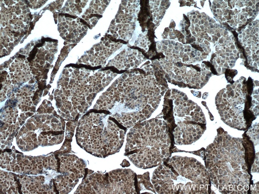 [66585-1-IG-20UL] WBP2 Monoclonal antibody
