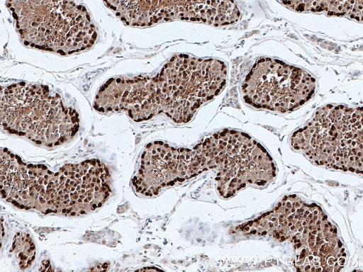[66587-1-IG-20UL] DNAJB6 Monoclonal antibody