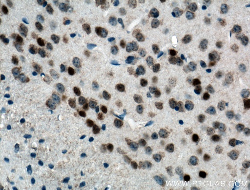 [66590-1-IG-150UL] FOS Monoclonal antibody