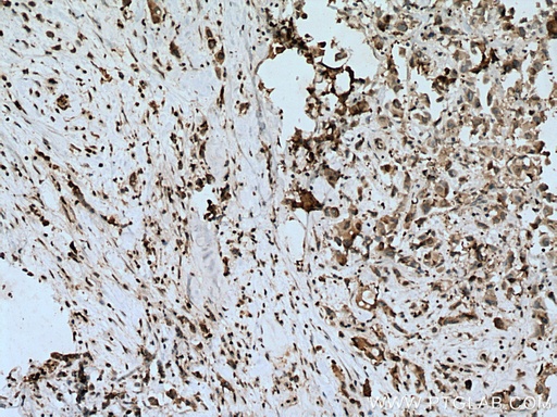 [66591-1-IG-150UL] FASN Monoclonal antibody