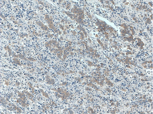 [66592-1-IG-20UL] RAF1 Monoclonal antibody