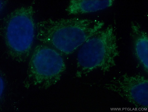 [66593-1-IG-20UL] TOM70 Monoclonal antibody