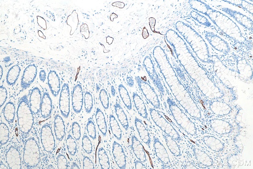 [66594-1-IG-20UL] MAdCAM1 Monoclonal antibody