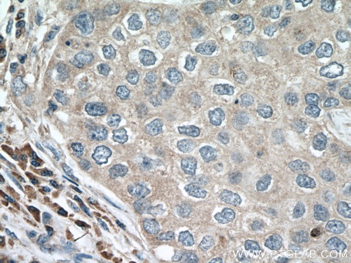[66596-1-IG-150UL] ACAP1 Monoclonal antibody