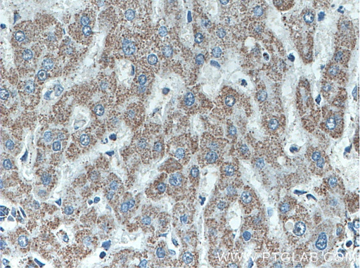[66600-1-IG-150UL] ATPB Monoclonal antibody