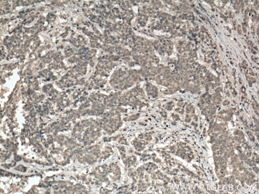 [66601-1-IG-150UL] PALLD,palladin Monoclonal antibody