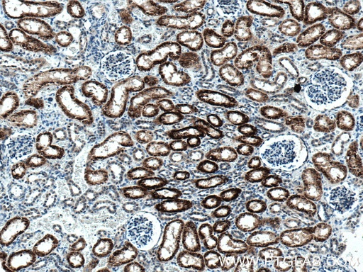 [66602-1-IG-150UL] AGXT2 Monoclonal antibody