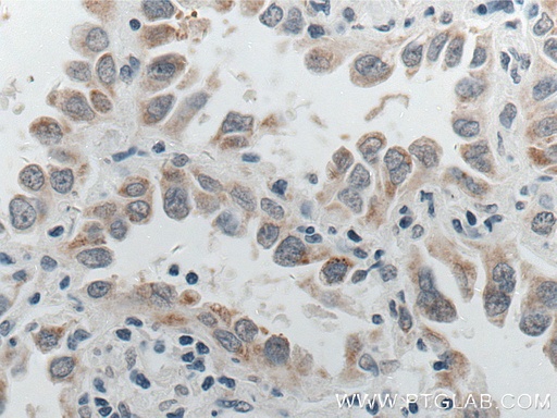 [66604-1-IG-20UL] P4HA2 Monoclonal antibody