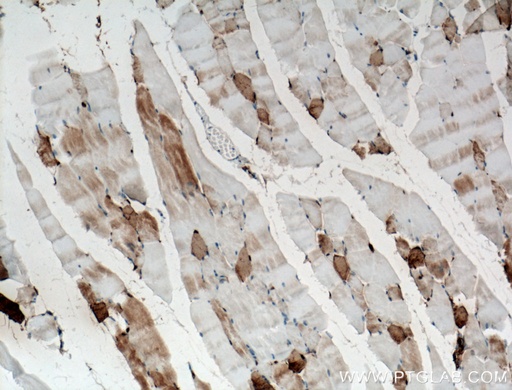 [66608-1-IG-20UL] CA3 Monoclonal antibody