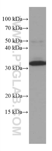 [66609-1-IG-150UL] MMACHC Monoclonal antibody