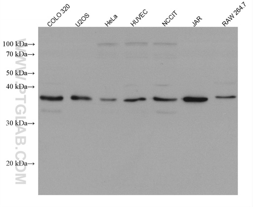 [66610-1-IG-150UL] RANKL Monoclonal antibody