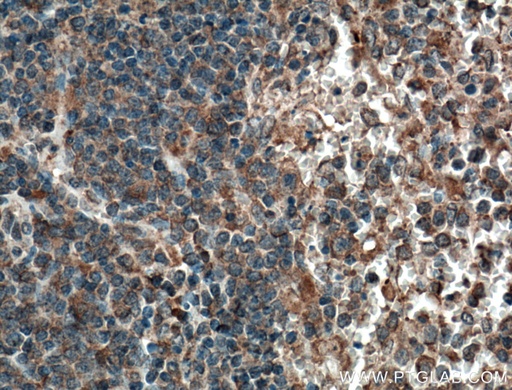[66611-1-IG-20UL] CCRL2 Monoclonal antibody