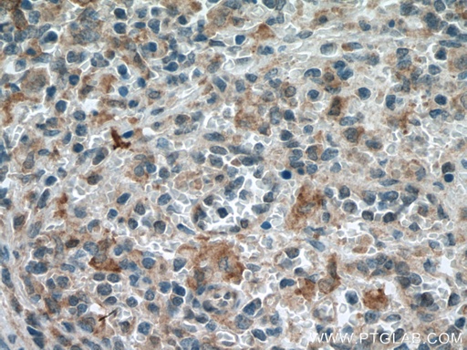 [66612-1-IG-20UL] MTHFR Monoclonal antibody
